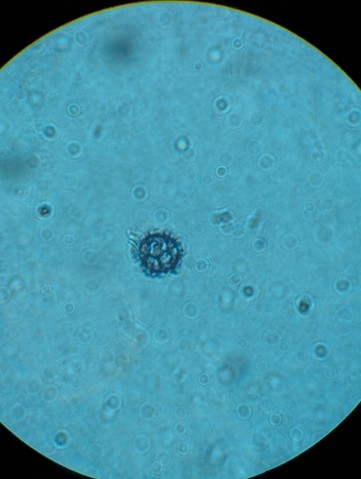 Common Milkcaps (Lactarius sp.)