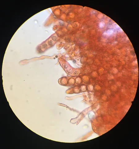 undefined (Densocarpa shanorii)
