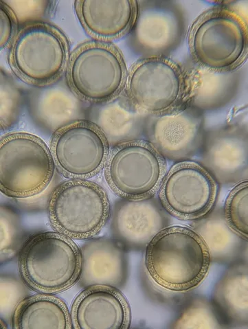undefined (Elaphomyces spp.)