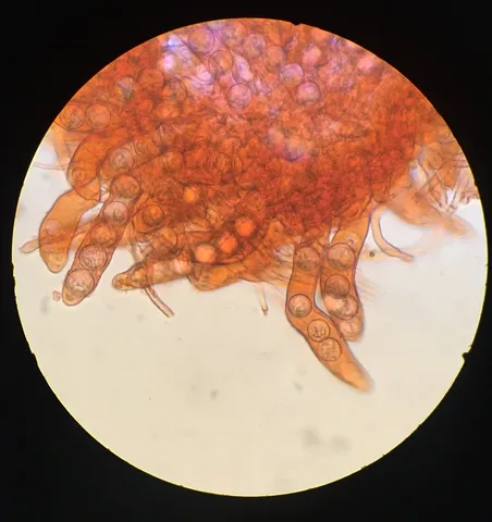 undefined (Densocarpa shanorii)