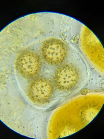 Truffles (Tuber sp.)