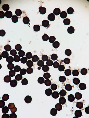 undefined (Elaphomyces sp.)