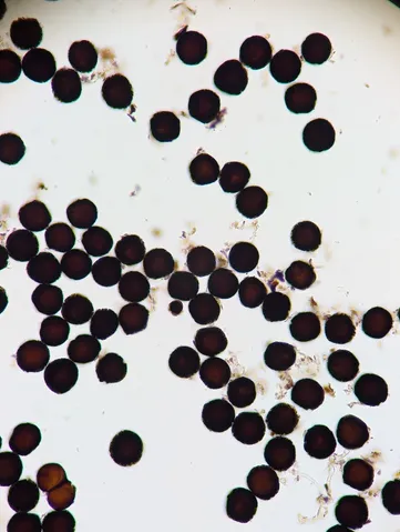 undefined (Elaphomyces spp.)