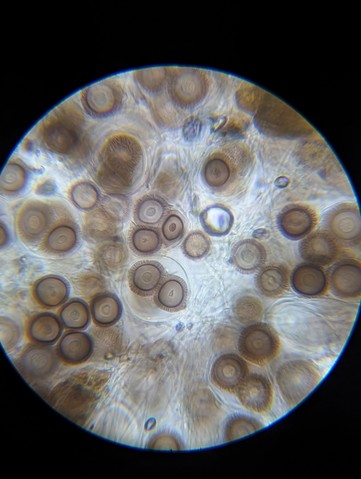 undefined (Elaphomyces sp.)