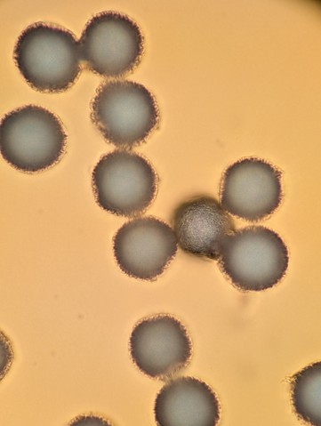 undefined (Elaphomyces sp.)