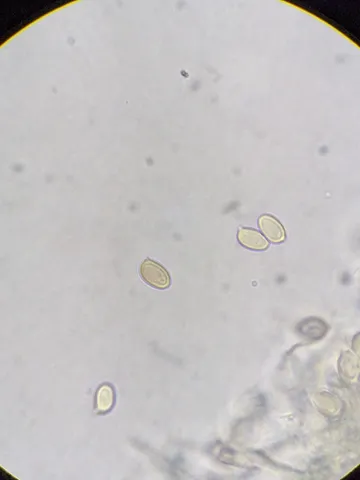 undefined (Leucoagaricus sp. 'IN03')
