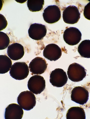 undefined (Elaphomyces sp.)