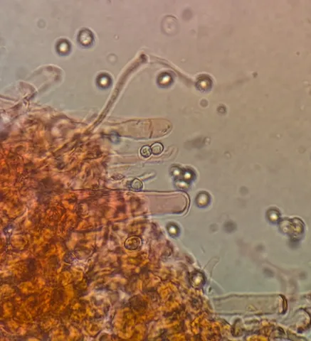 undefined (Pluteus septocystidiatus)