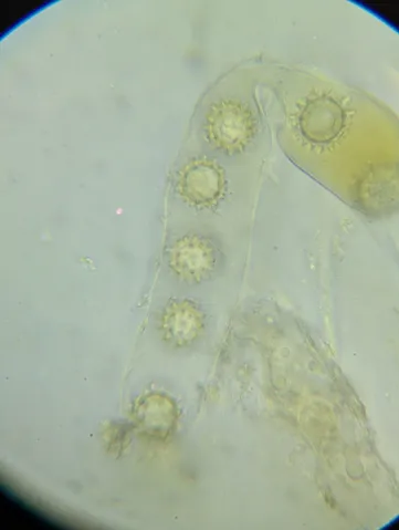 undefined (Pachyphlodes carnea)