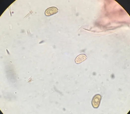 undefined (Psathyrella inflatocystis)