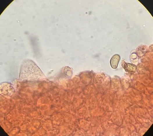 undefined (Psathyrella inflatocystis)