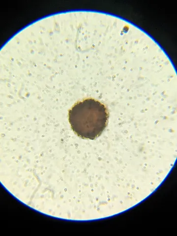 undefined (Elaphomyces spp.)