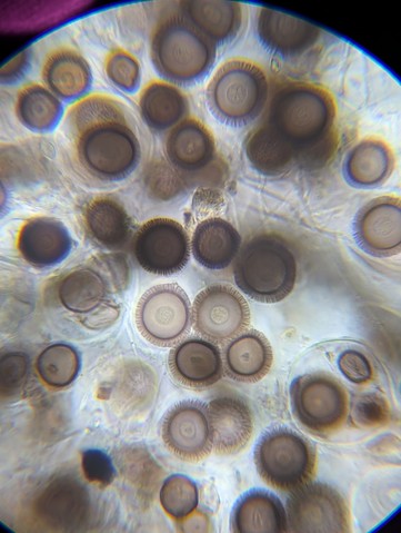 undefined (Elaphomyces sp.)