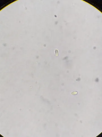 undefined (Cystolepiota cystidiosa)