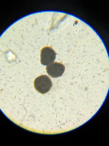 undefined (Elaphomyces sp.)