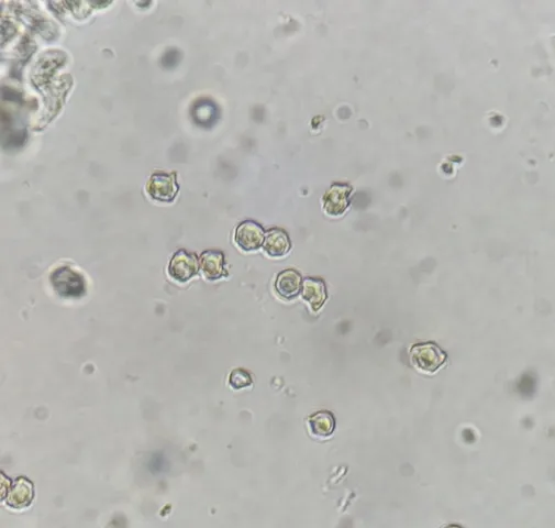 undefined (Entoloma sp. 'IN56')