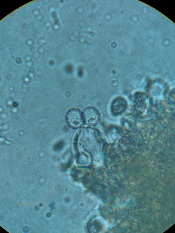 Common Milkcaps (Lactarius sp.)