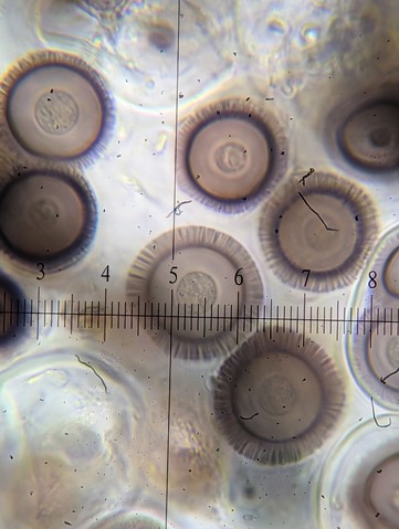 undefined (Elaphomyces sp.)