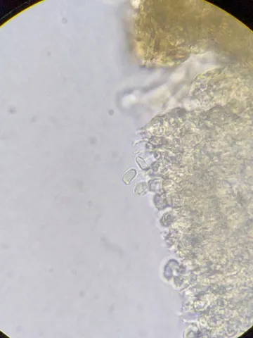 undefined (Cystolepiota cystidiosa)