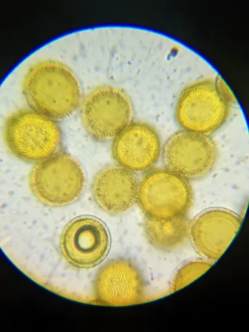 undefined (Elaphomyces spp.)