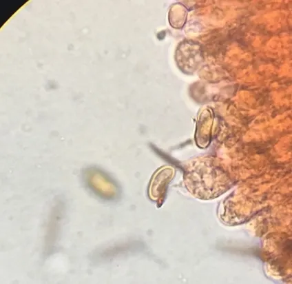 undefined (Psathyrella inflatocystis)