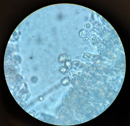 undefined (Entoloma sp. 'IN56')