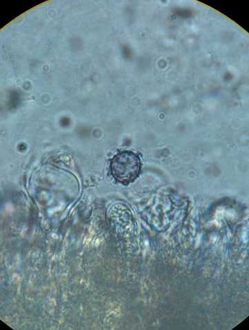 Common Milkcaps (Lactarius sp.)