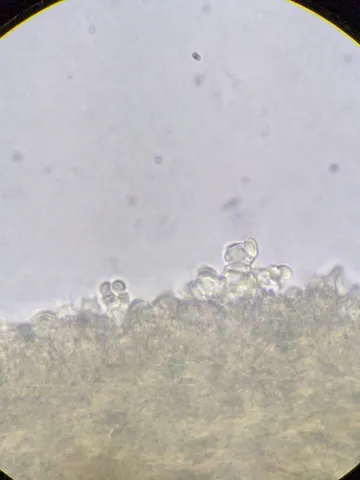 undefined (Cystolepiota cystidiosa)