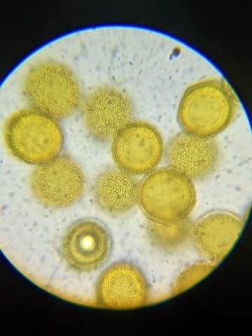 undefined (Elaphomyces sp.)
