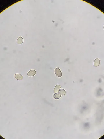 undefined (Leucoagaricus sp. 'IN03')