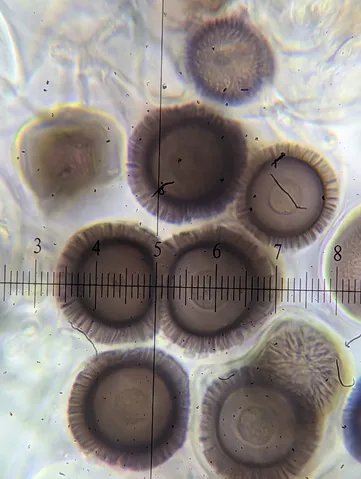 undefined (Elaphomyces spp.)