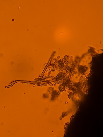 undefined (Elaphomyces sp.)