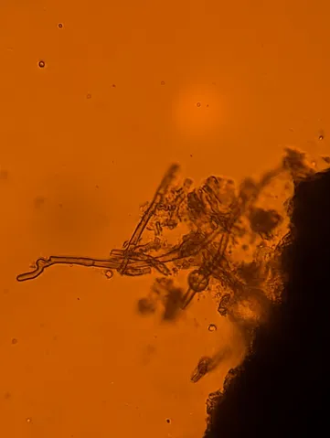 undefined (Elaphomyces spp.)