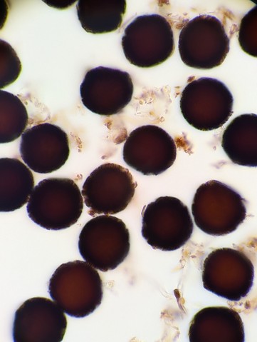 undefined (Elaphomyces sp.)