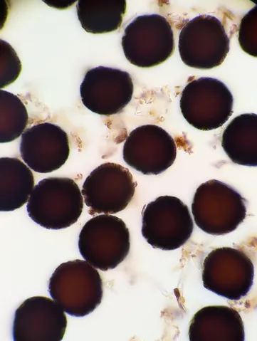 undefined (Elaphomyces spp.)