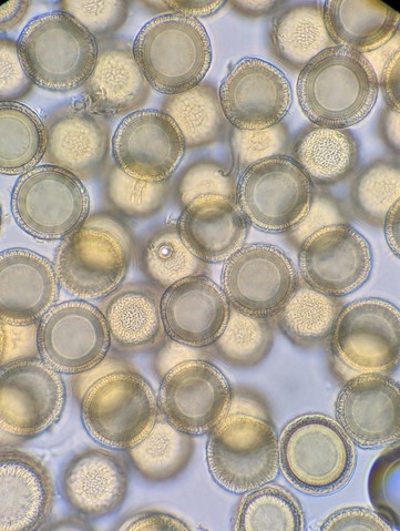 undefined (Elaphomyces sp.)