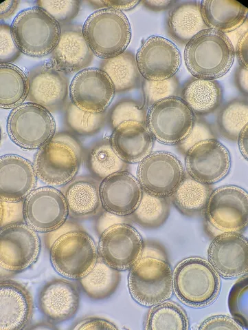 undefined (Elaphomyces spp.)