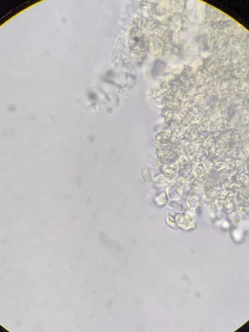 undefined (Cystolepiota cystidiosa)