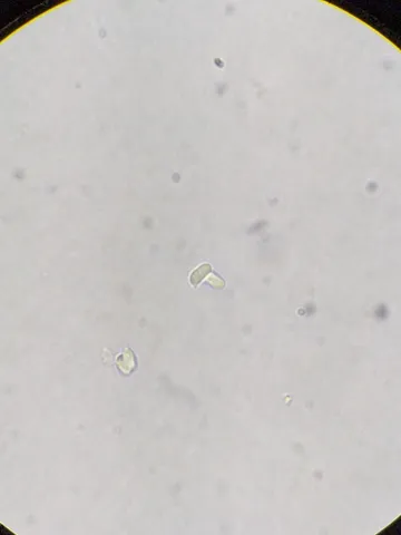 undefined (Cystolepiota cystidiosa)
