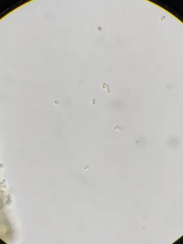 undefined (Cystolepiota cystidiosa)