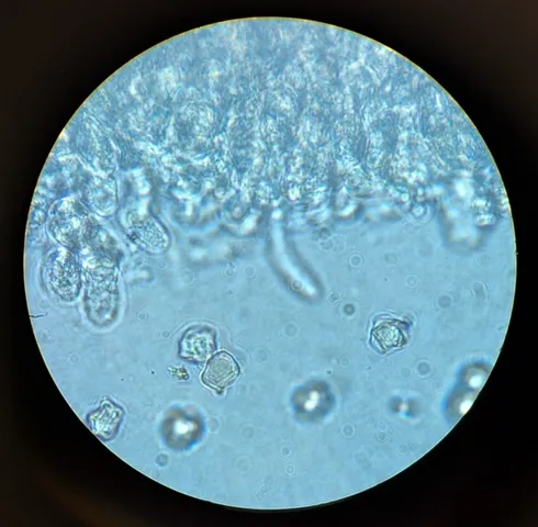 undefined (Entoloma sp. 'IN56')