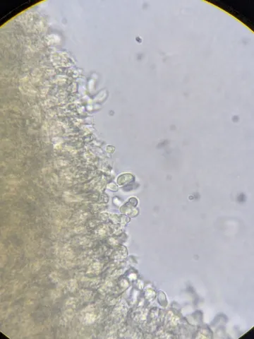 undefined (Cystolepiota cystidiosa)