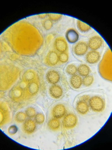 Truffles (Tuber sp.)