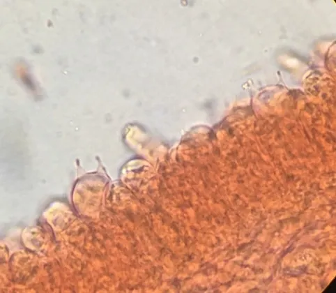 undefined (Psathyrella inflatocystis)