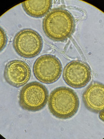 undefined (Elaphomyces sp.)