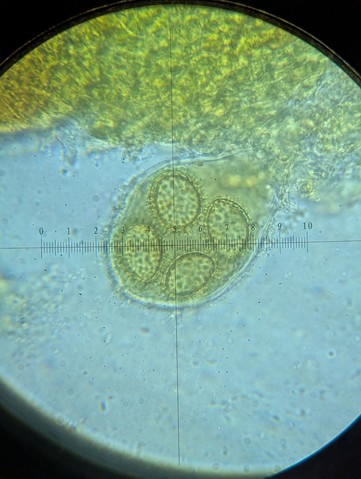 undefined (Tuber rugosum)