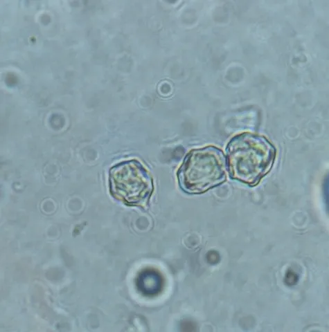 undefined (Entoloma sp. 'IN56')