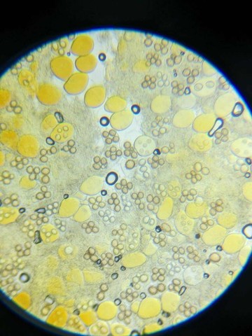 Truffles (Tuber sp.)