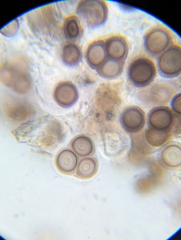 undefined (Elaphomyces sp.)