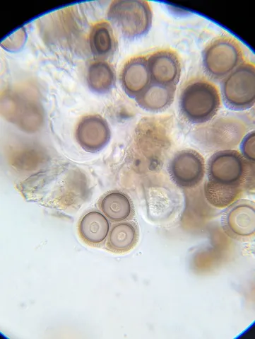 undefined (Elaphomyces spp.)